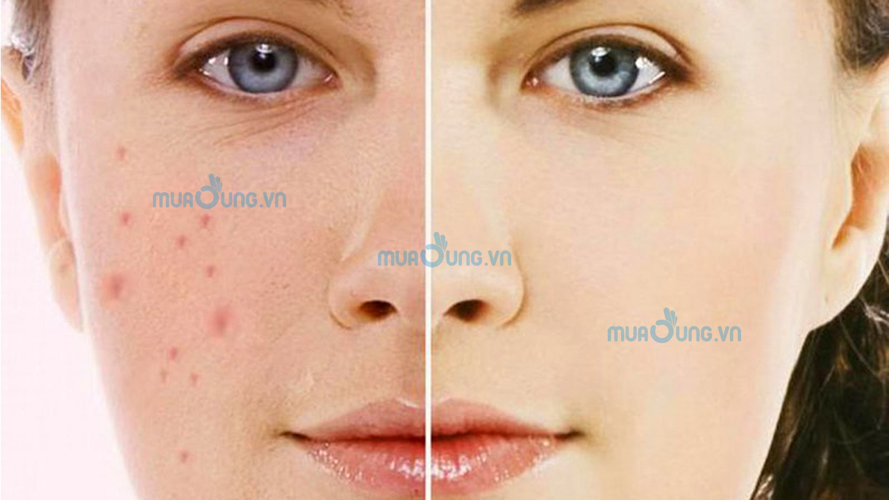 Dấu hiệu nhận biết rối loạn nội tiết tố nữ.