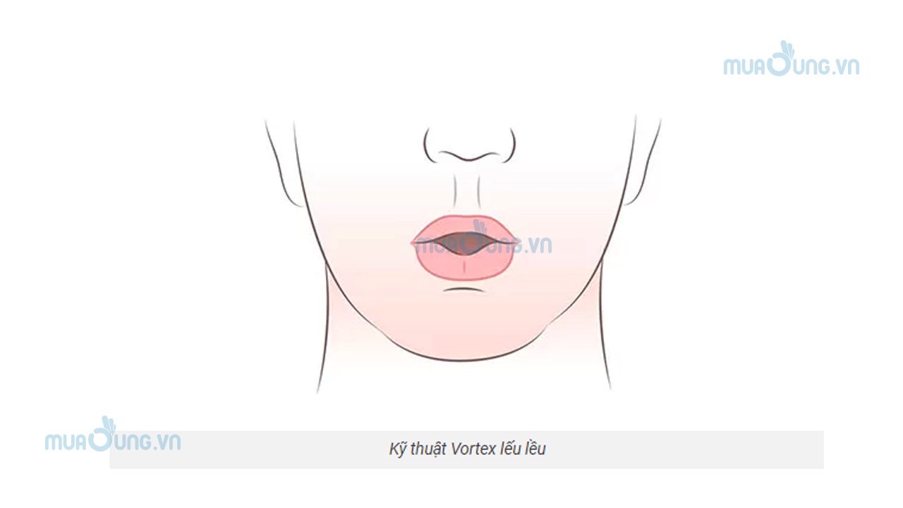 Kỹ thuật Vortex lếu lều