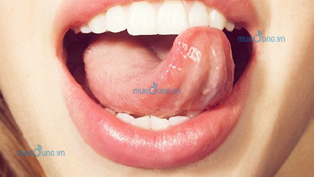 Lếu lều là gì?