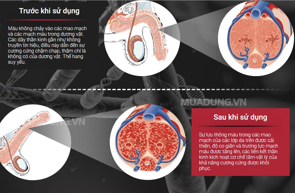 cơ chế hoạt động