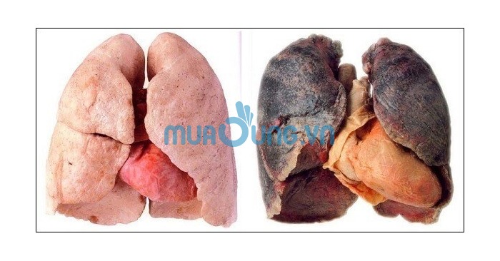 Hút thuốc lá có hại cho sức khỏe